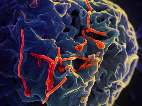 ebola-disease